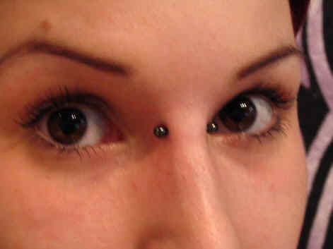 piercing infection. nose piercing infections