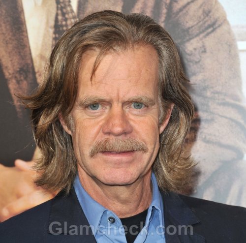 William H Macy in Recovery After Removal of Cancer Spot