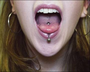 Tongue rings