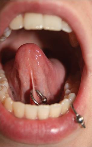 Frenulum linguae piercing