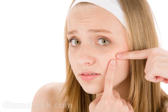 Effective Ideas for Natural Acne Treatment