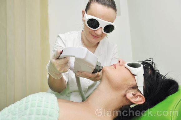 Laser hair removal face