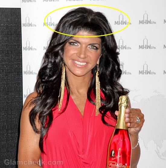 Teresa Giudice and her Faux Scalp