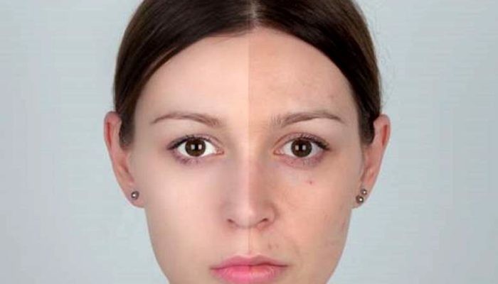 Natural Ways to Remove Tan