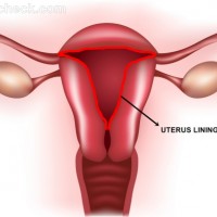 Menstruation uterus lining