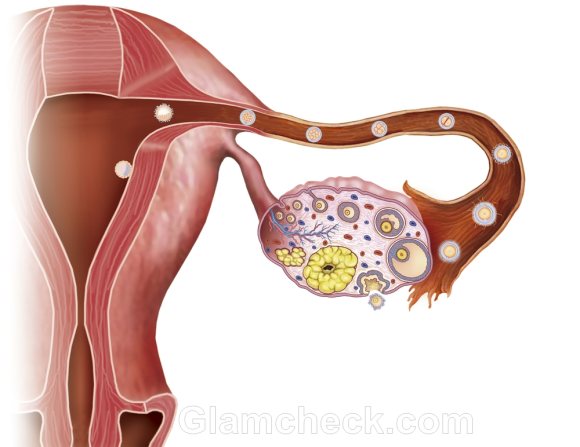 Ovary cancer detection