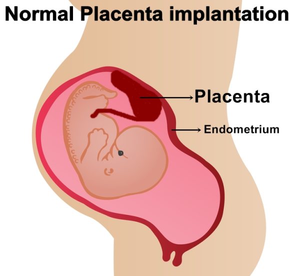 placenta implantation normal