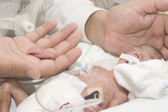 preterm labor premature baby