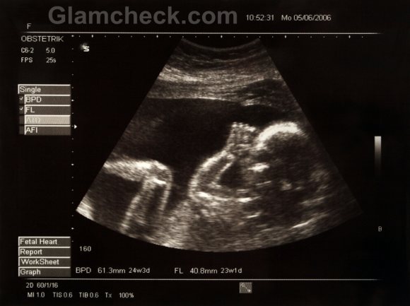 Amniocentesis ultrasound