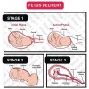 Labor Delivery stages