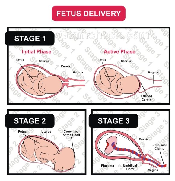 Labor Delivery stages