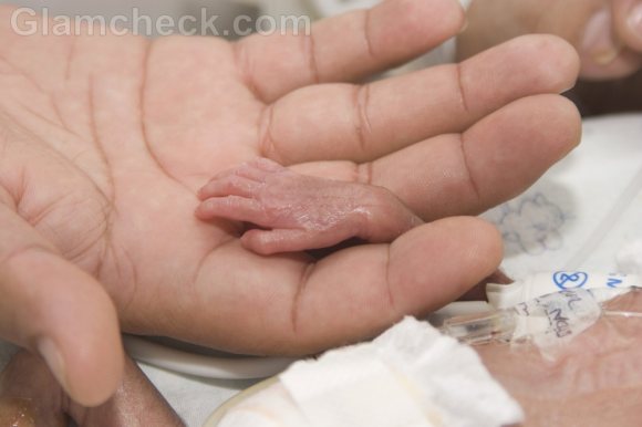 preterm birth premature baby