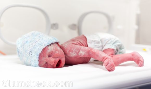 preterm birth