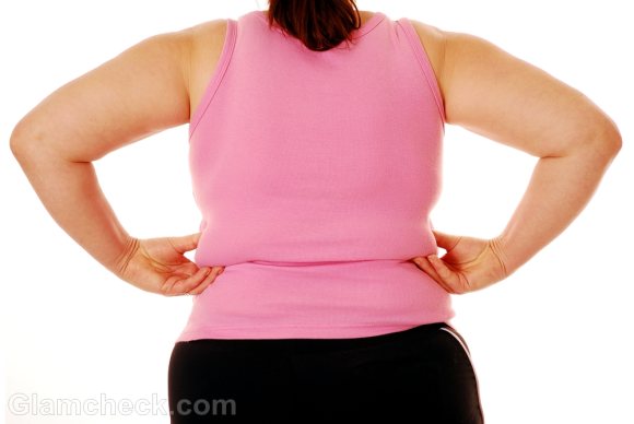 Health Effects of Obesity
