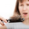 Hair Loss Causes women