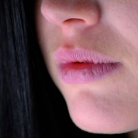 Cracked Lips Causes Symptoms and Treatment