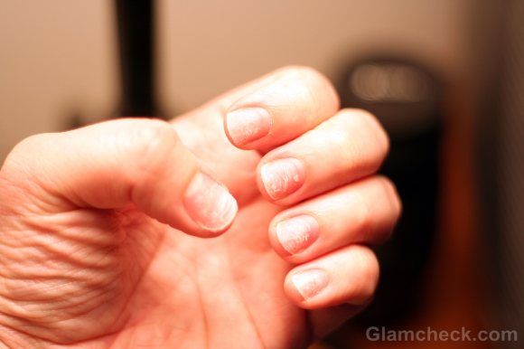 cracked-nails