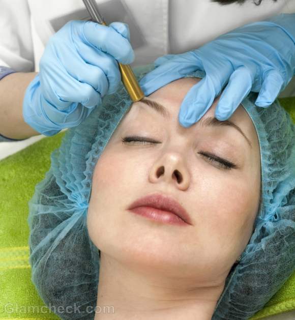 Scar therapy Microdermabrasion minimize scars