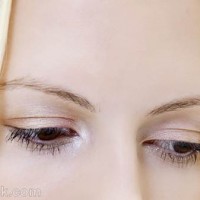 Loss of eyelashes