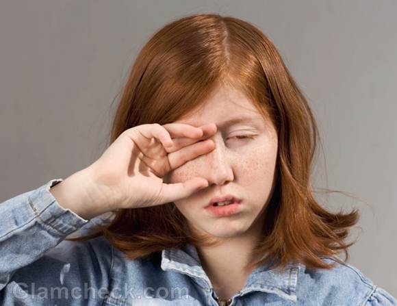 lazy eye symptoms causes treatment