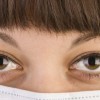 How avoid prevent puffy eyes