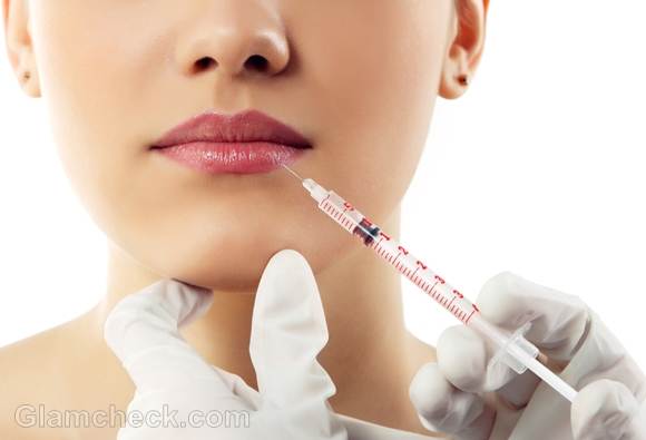 lip-augmentation-cosmetic-surgery-for-lips